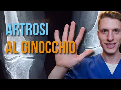 Artrosi al ginocchio: caldo o freddo? Quali rimedi e terapie scegliere