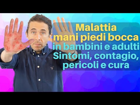 Bocca mani piedi senza bolle