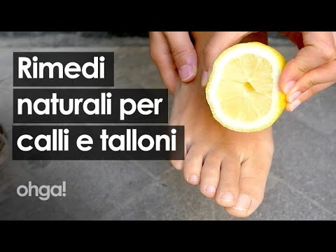 Callo in mezzo alle dita dei piedi