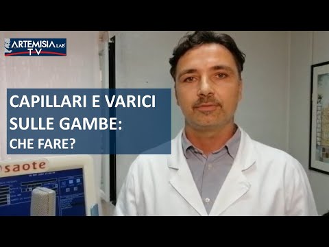 Capillari fragili gambe cosa fare