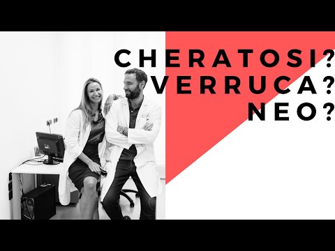 Cheratosi seborroica infiammata e sanguinante
