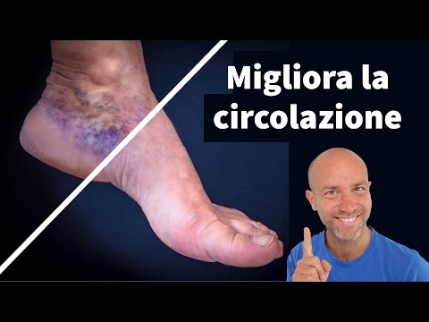 Come aiutare la circolazione delle gambe