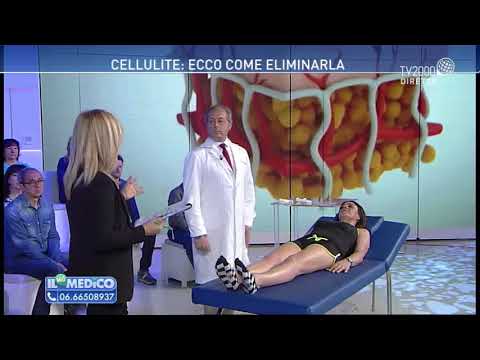 Come diminuire la cellulite sulle cosce
