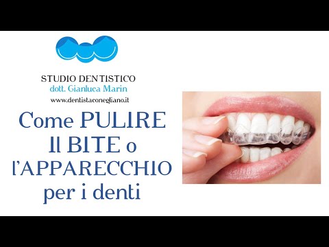 Come pulire il bite per i denti