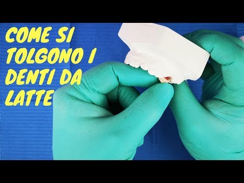 Come togliere un dente senza farsi male