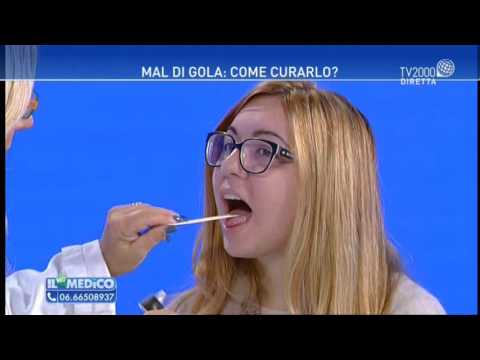 Cosa fare se brucia la gola