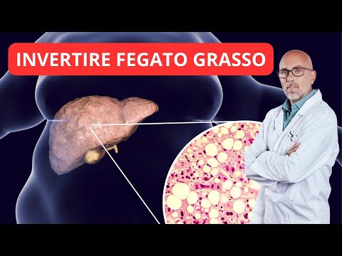 Cura e prevenzione per il fegato grasso