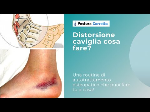 Dolore alla caviglia dopo una storta