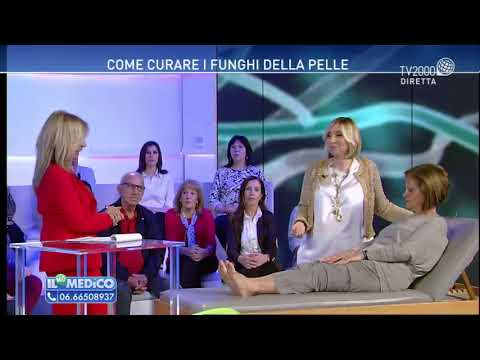 Eliminare i funghi della pelle velocemente: rimedi efficaci