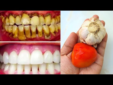 Farmaci per rinforzare i denti