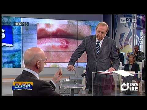 Herpes da stress sul corpo