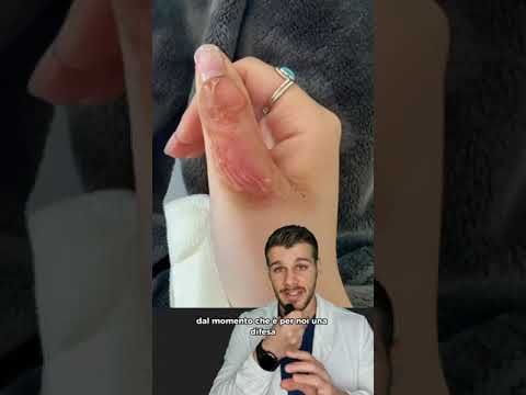 Prendere il sole dopo mangiato