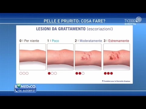 Puntini rossi sulla pelle delle gambe: cause e rimedi naturali