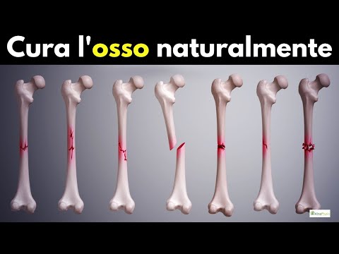 Punture per calcificare le ossa