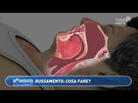 Russare nelle donne: cause, rimedi e quando consultare un medico