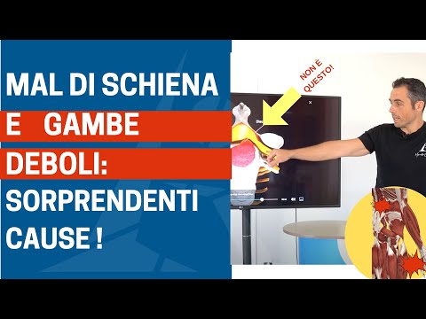 Sensazione di gambe che cedono