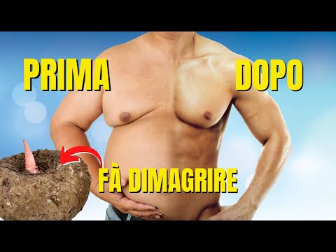 Supremo slim 5 dosaggio sciroppo